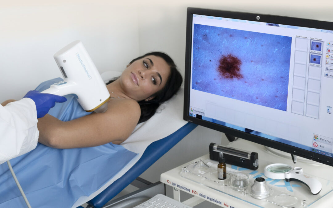 Screening dermatoscopico e prevenzione melanoma