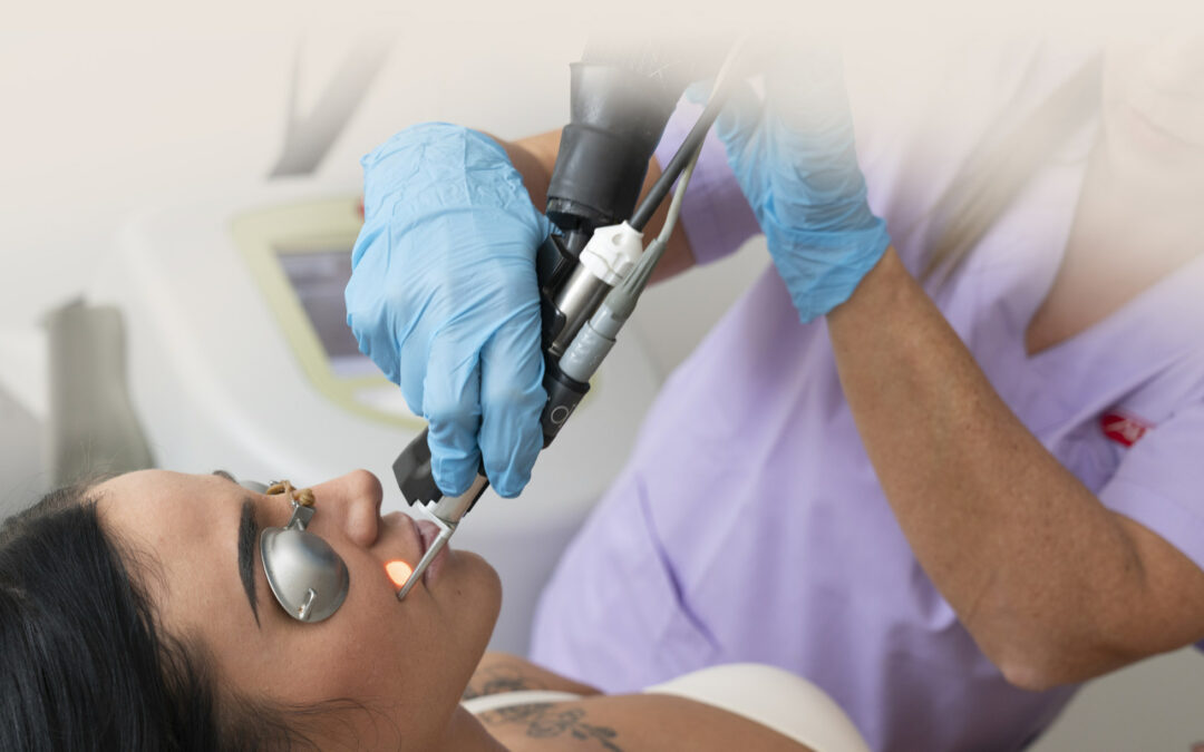 Trattamenti Laser